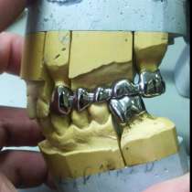 Отлив литья для зубных техников, в Москве