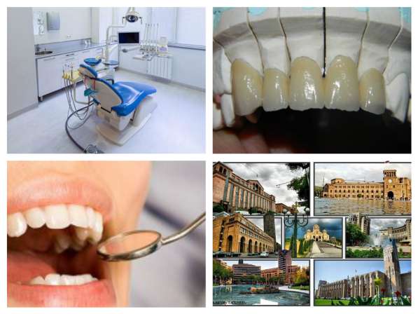 Стоматологический тур в Армению