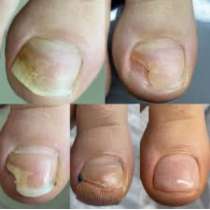 Подолог, в Краснодаре